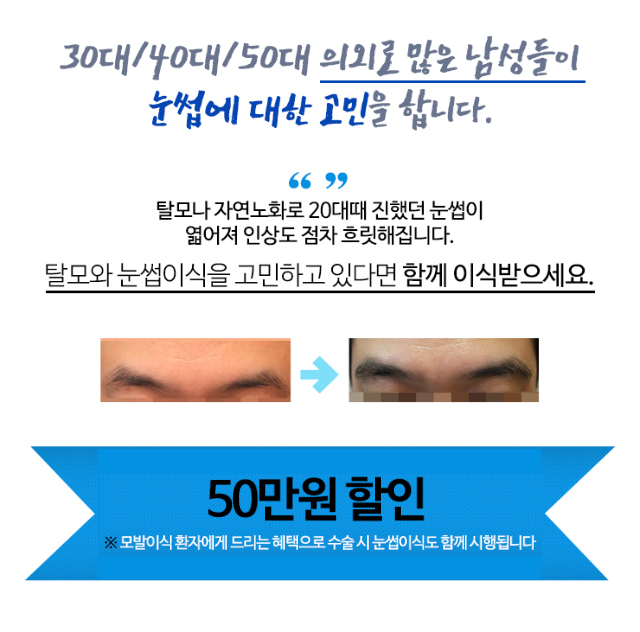 눈썹이식 눈썹모발이식.jpg