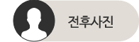 전후사진 바로가기