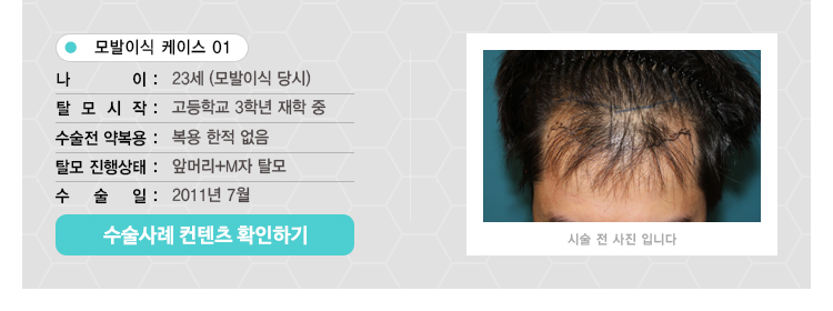 수술사례 컨텐츠1