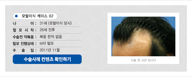 수술사례 컨텐츠2
