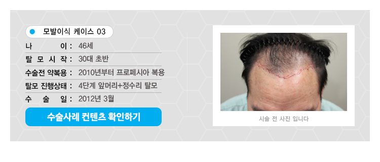 수술사례 컨텐츠3